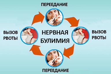 Лечение булимии в Погаре